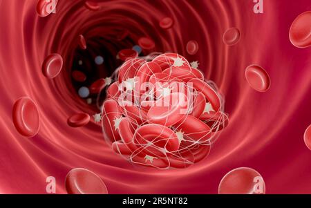 Blood clot, illustration Stock Photo