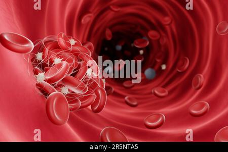 Blood clot, illustration Stock Photo