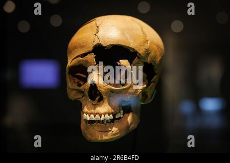 Bramsche, Germany. 08th June, 2023. View of the skull of a killed man. In 2018, the Varus Battle Museum in Kalkriese found a Roman splint armor during excavations - according to the museum, the oldest so far and the only one preserved worldwide. The museum is showing further exhibits on this in the special exhibition 'Cold Case - Death of a Legionnaire' from June 10 to Nov. 5, 2023. Credit: Friso Gentsch/dpa/Alamy Live News Stock Photo