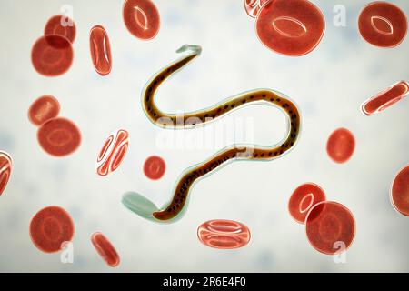 Wuchereria bancrofti. Computer illustration of the microfilaria larval stage of the parasitic worm Wuchereria bancrofti, which causes filariasis in hu Stock Photo