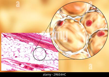 Fat cells, light micrograph and computer illustration. White adipose ...