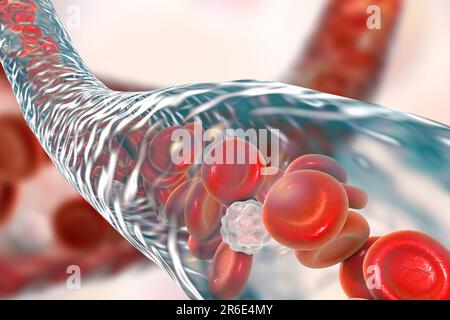 Blood vessel, computer illustration. Red blood cells and white blood cells inside a blood vessel. Stock Photo