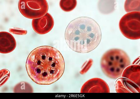 Protozoan Plasmodium malariae inside red blood cells, computer artwork. P. malariae is the causative agent of Quartan Malaria, also known as malarial Stock Photo