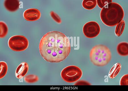 Protozoan Plasmodium malariae inside red blood cells, computer artwork. P. malariae is the causative agent of Quartan Malaria, also known as malarial Stock Photo