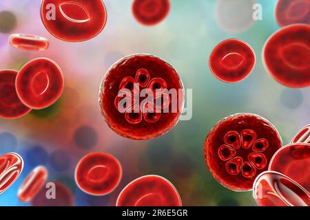 Protozoan Plasmodium malariae inside red blood cells, computer artwork. P. malariae is the causative agent of Quartan Malaria, also known as malarial Stock Photo