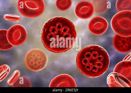 Protozoan Plasmodium malariae inside red blood cells, computer artwork. P. malariae is the causative agent of Quartan Malaria, also known as malarial Stock Photo