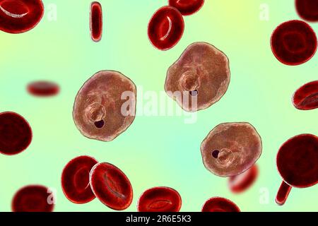 Protozoan Plasmodium ovale inside red blood cell, computer artwork. P. ovale is the causative agent of Benign Tertian Malaria, also known as ovale mal Stock Photo