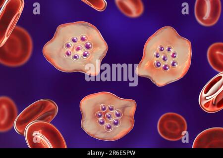 Protozoan Plasmodium ovale inside red blood cell, computer artwork. P. ovale is the causative agent of Benign Tertian Malaria, also known as ovale mal Stock Photo