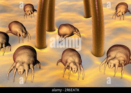 Dust mites (Dermatophagoides pteronyssinus) on human skin, computer illustration. This mite is eight legged. Its rounded, unsegmented body has a few t Stock Photo