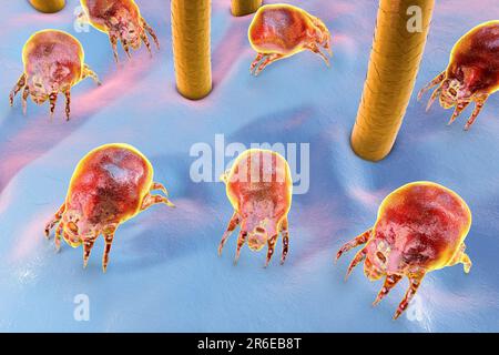 Dust mites (Dermatophagoides pteronyssinus) on human skin, computer illustration. This mite is eight legged. Its rounded, unsegmented body has a few t Stock Photo