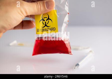 Biohazard specimen plastic bag on a white background Stock Photo