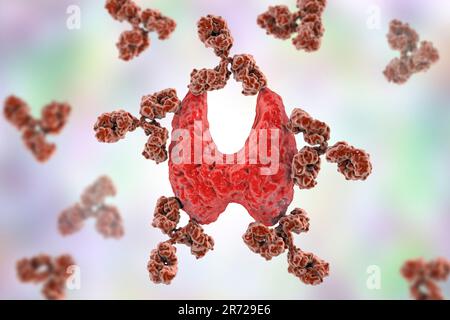 Autoimmune thyroiditis (Hashimoto's disease), conceptual image. Illustration shows antibodies attacking thyroid gland. Stock Photo