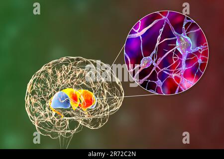 Dorsal striatum in the brain and closeup view of its neurons, computer illustration. It is a nucleus in the basal ganglia, consists of the caudate nuc Stock Photo