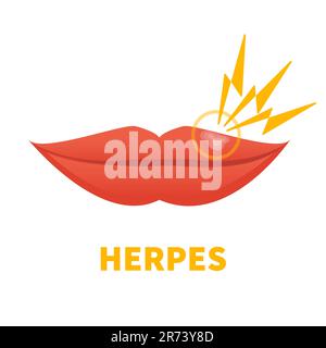 Herpes HSV cold sore lip outbreak medical icon Stock Vector