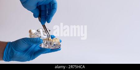 Doctor's hand in blue gloves holds a tooth model on a white Stock Photo