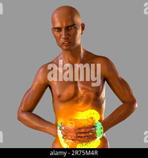 Abdominal pain and cramping in African man because of irritable bowel syndrome (IBS), conceptual computer illustration with highlighted intestine show Stock Photo