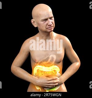 Abdominal pain and cramping in a man because of irritable bowel syndrome (IBS), conceptual computer illustration with highlighted intestine showing bo Stock Photo
