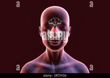 Human paranasal sinuses, computer illustration. The sinuses are membrane-lined air-filled spaces in the bones of the face. The frontal sinuses are abo Stock Photo