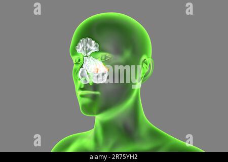 Human paranasal sinuses, computer illustration. The sinuses are membrane-lined air-filled spaces in the bones of the face. The frontal sinuses are abo Stock Photo