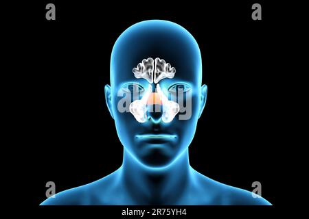 Human paranasal sinuses, computer illustration. The sinuses are membrane-lined air-filled spaces in the bones of the face. The frontal sinuses are abo Stock Photo