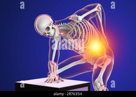Back pain. Conceptual computer artwork of a human body with highlighted skeleton holding a hand to the lower back. Lower back pain, called lumbago, is Stock Photo