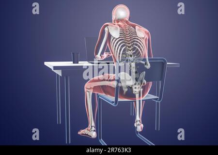 Computer Sating Body Working with laptop in a wrong position. Concept of back pain. Computer ...
