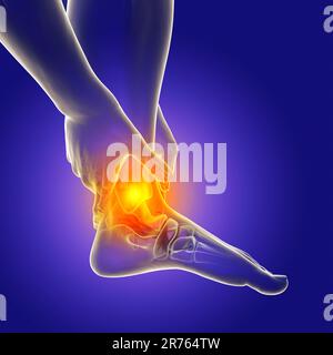 Foot and ankle pain, conceptual computer illustration. Achilles heel pain. Stock Photo