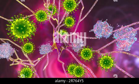 Infectious etiology of dementia, conceptual computer illustration. Neuropsychiatric sequelae of Covid-19. Viruses infecting neurons and progressive im Stock Photo