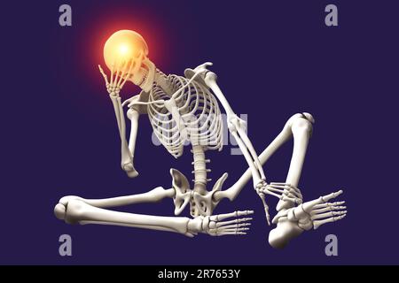 Headache, computer artwork. Skeleton holding its head in pain. The red area in the skull represents the pain of a headache. Headaches are generally ca Stock Photo