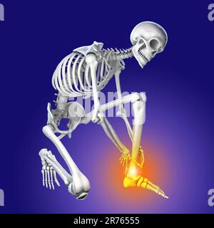 Foot and ankle pain, conceptual computer illustration. Achilles heel pain. Stock Photo