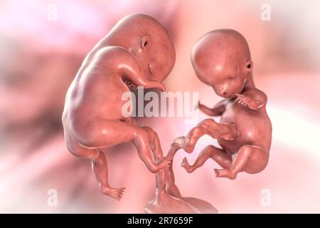 Multiple pregnancy, illustration. Monozygotic twins in the uterus sharing the same placenta. Early fetal period, week 8 - week 16. Stock Photo