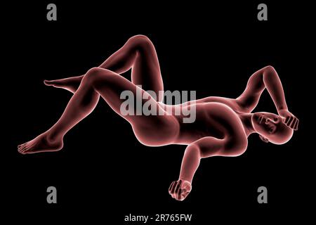 Human male body in a bad feeling unconsciousness position, conceptual computer illustration. Stock Photo