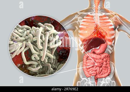 Round worms in human intestine, computer artwork. Roundworms, or nematodes, include numerous free-living and pathogenic species. Nematodes that common Stock Photo