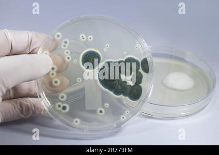 Colonies of Penicillium fungi grown on Sabouraud Dextrose Agar (SDA). Penicillium is a mold fungus that causes food spoilage, used in cheese productio Stock Photo