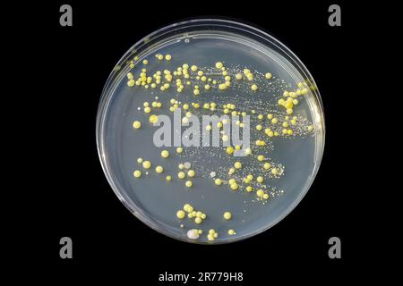 Bacteria grown from skin smear, colonies of Micrococcus luteus and Staphylococcus epidermidis on Petri dish with Tryptic soy agar. Stock Photo