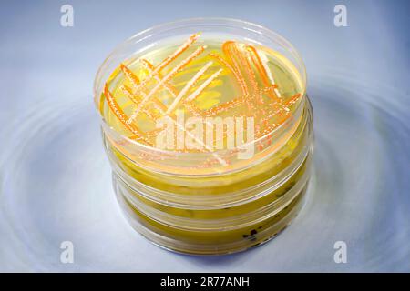 Mixed culture of bacteria and fungi of different colors grown on a Petri dish with nutrient medium. Stock Photo