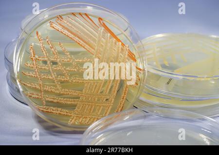 Mixed culture of bacteria of different colors grown on Petri dish with nutrient medium, close-up view. Stock Photo