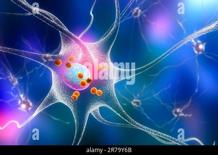 Parkinson's disease. 3D illustration showing neurons containing Lewy ...