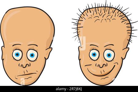 Comic vector illustration - A patient with a bald head and growing hair Stock Vector