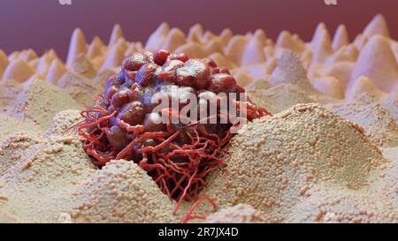 Cancer cell growth uncontrollably over tissue, Tumor infection cells and spreading, Invasive inflammation metastasis cancerous. reproduce by duplicati Stock Photo