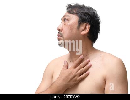 Acrochordon hi-res stock photography and images - Alamy