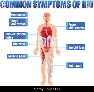 Informative poster of common symptoms of HIV illustration Stock Vector