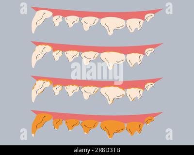 Stages of plaque and tartar formation in dogs. Gum disease prevention. Dog dental care concept. Vector illustration. Stock Vector
