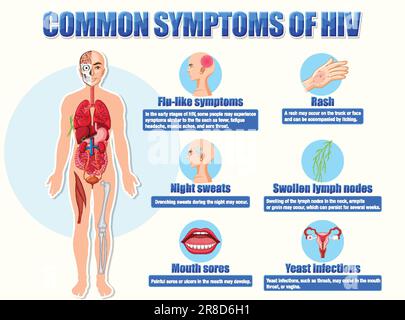 Informative poster of common symptoms of HIV illustration Stock Vector