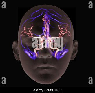 Coloured 3D computed tomography (CT) angiogram scan showing the arteries and veins supplying and draining blood from the brain of a 35 year old male patient. At the base of the skull the arteries form the circle of Willis (centre). Stock Photo