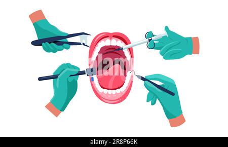 Dental treatment. Dentist hands in medical rubber gloves with instruments working on patient mouth, oral care concept. Vector cartoon illustration of Stock Vector