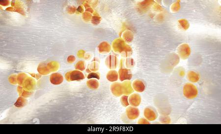 Colony of Staphylococcus aureus bacteria. Staphylococci are the most common cause of biofilm associated infections. Bacterial biofilms Stock Photo