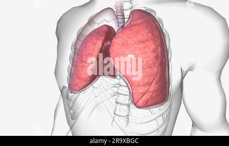 Pneumothorax is a pulmonary condition in which air accumulates around ...