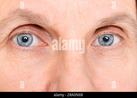 Closeup of adult woman eyes wearing soft contact lenses Stock Photo