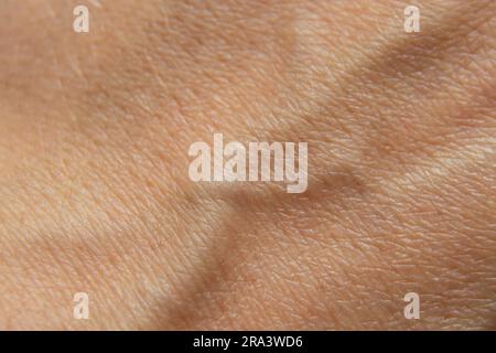 bulging vein on human hand as background close up Stock Photo